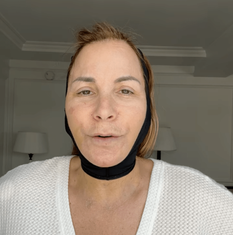 Jill Zarin, ancienne de « RHONY », révèle qu'elle a reçu une greffe de visage à 60 ans !