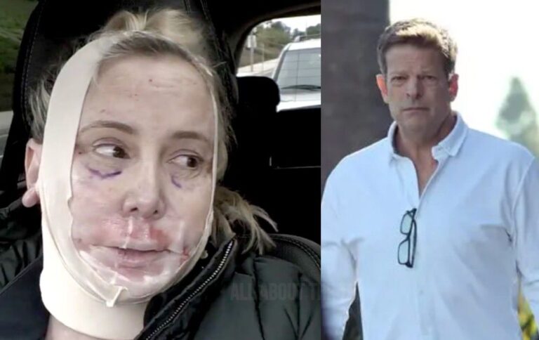 L'ex de Shannon Beador, John Janssen, nie sa demande de 75 000 $ pour un lifting : « Complètement faux »