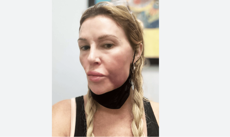 Brandi Glanville déclare que la franchise « Real Housewives » est « terminée » au milieu du chaos juridique !
