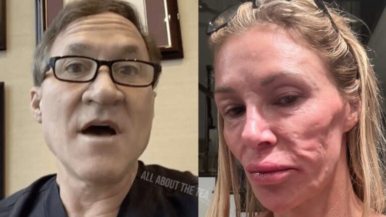 Le Dr Terry Dubrow déclare que le visage défiguré de Brandi Glanville est une « bombe à retardement »