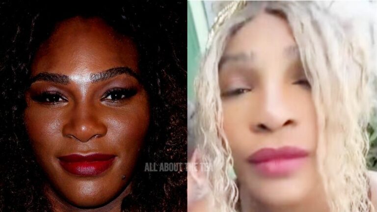Serena Williams nie avoir suivi les traces de Michael Jackson en blanchissant sa peau !