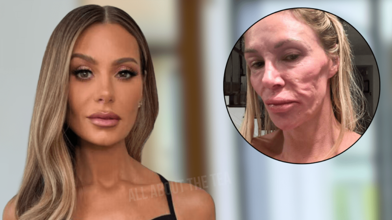 «  Rhobh '' Alum Brandi Glanville affirme que Dorit Kemsley utilise de la cocaïne