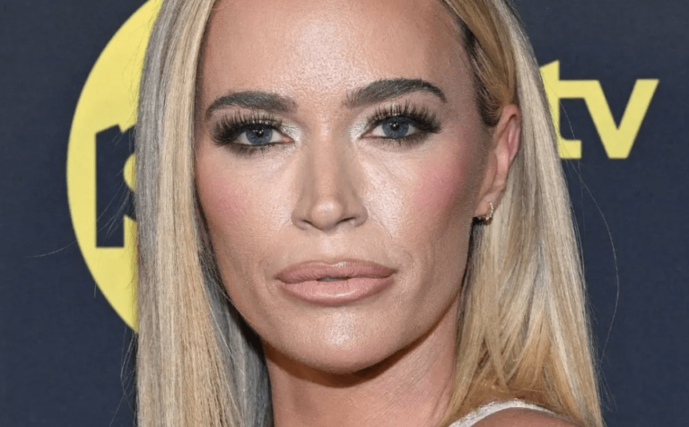 «  Rhobh '' Alum Teddi Mellencamp, s'ouvre sur ses cotes de 50/50 dans le combat contre le cancer du cerveau
