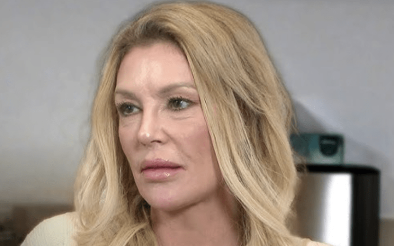 Brandi Glanville brûle son visage avec Nair… affirme qu'un parasite nommé «Caroline» vit sous sa peau!