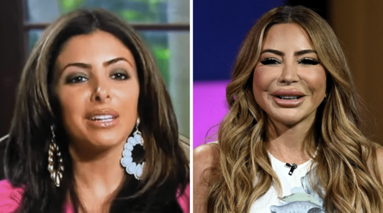 Larsa Pippen brise le silence sur les photos virales de visage enflé… affirme que son traitement PRP a mal tourné!